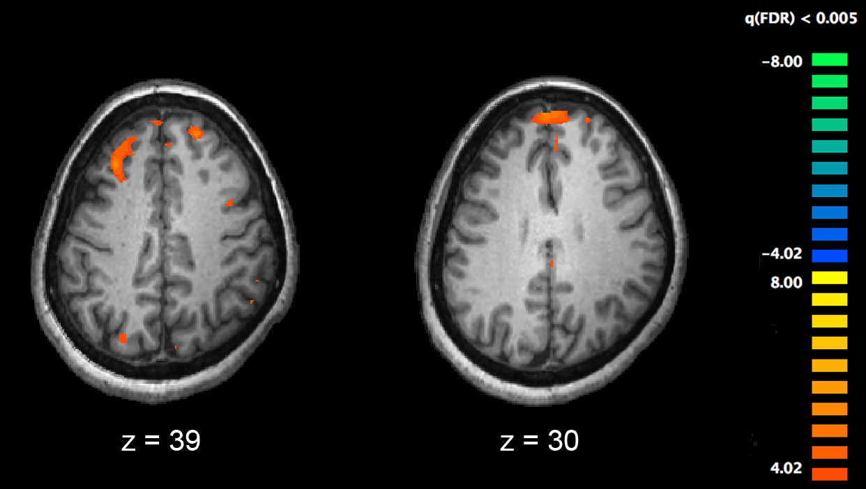 schizophrenia_fmri_working_memory