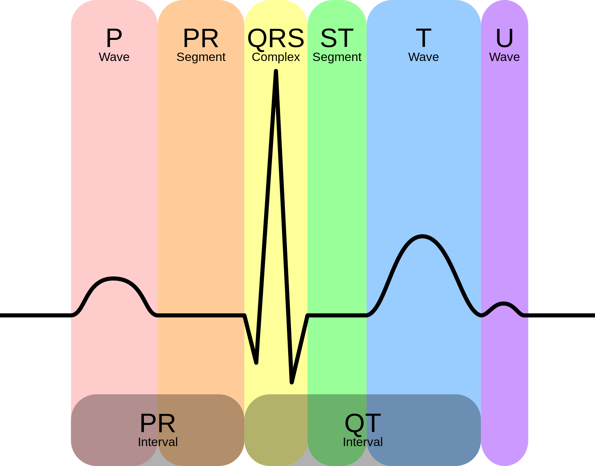 Pqrst Chart